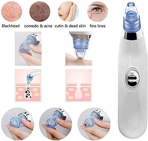 Electric Blackhead Remover Pore Vacuum