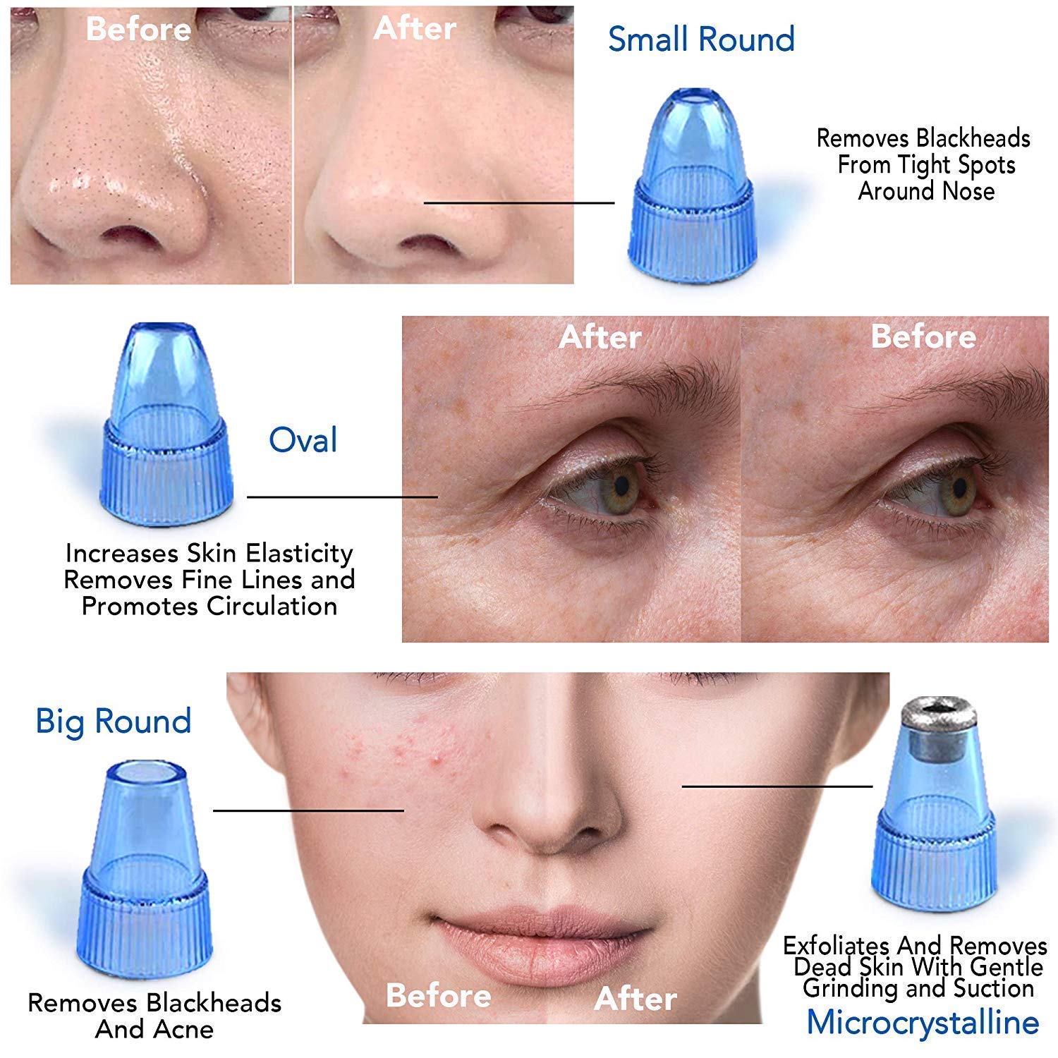 Electric Blackhead Remover Pore Vacuum